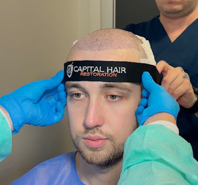 Capital Hair Restoration - Hair Transplant 1 Capital Hair Restoration – Hair Transplant